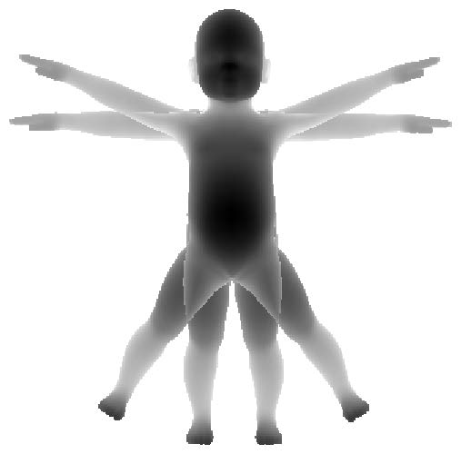 Motion Tracking Of Infants In Risk Of Cerebral Palsy Mikkel Front